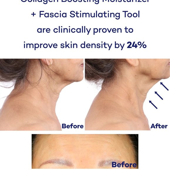 Pause Well-Aging Fascia Stimulating Tool - Picture 3 of 5